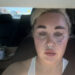 Amanda Bynes revela que recebeu injeções labiais enquanto compartilha um novo visual em selfie de carro