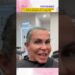 Com alopecia, Gretchen afirma que passará o verão de Portugal sem o mega hair