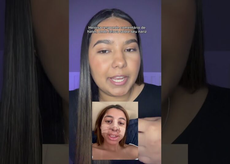 Heloísa responde comentário de hater, onde falava sobre seu nariz #fofoca #viral #polemica