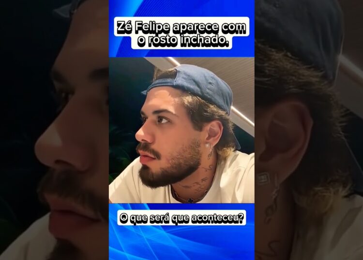 Zé Felipe aparece com o rosto inchado . #noticias #fofocas #entrevista