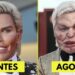 7 Desastres de Cirurgia Plástica de Celebridades que Você Nem Reconheceria Hoje