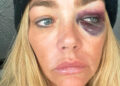 Denise Richards 'lutando pelo tempo da tela' e ordenhando seu divórcio bagunçado enquanto filmava 'RHOBH'