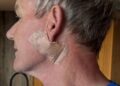 Gordon Ramsay revela diagnóstico de câncer de pele, cirurgia: 'Por favor, não se esqueça do seu filtro solar' - Globe Magazine