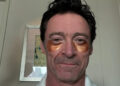 Hugh Jackman tratando Sutton Foster para uma viagem de spa antienvelhecimento em meio a uma reação ao romance (exclusivo)