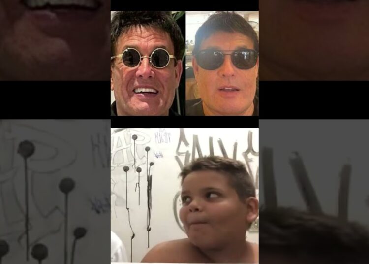 15 Harmonização Facial que deram errado
