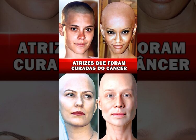🔴 Atrizes Que Foram Curadas Do Câncer! 🙌💖 Atrizes Famosas Que Venceram A Luta Contra A Doença! ✨💪