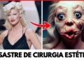 7 Desastres de Cirurgia Plástica que Fizeram as Estrelas de Hollywood Perderem Tudo!