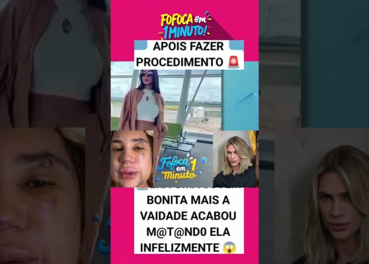 você faria esse procedimento? #fofocas #fofocadefamosos #fofoca #influenciador