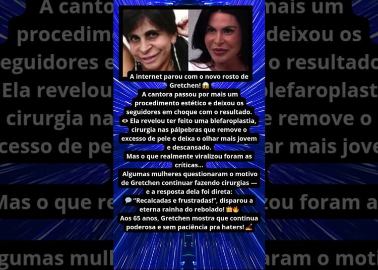 NOVO ROSTO DE GRETCHEN CHOCA A WEB! 👑🔥
