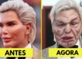 7 Desastres de Cirurgia Plástica de Celebridades que Você Nem Acredita que São Reais Hoje