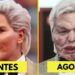7 Desastres de Cirurgia Plástica de Celebridades que Você Nem Acredita que São Reais Hoje