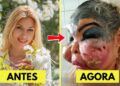 15 Cirurgias Plásticas de Celebridades Que Deram Errado e Vão Te Chocar | Antes e Depois 2025