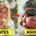 15 Cirurgias Plásticas de Celebridades Que Deram Errado e Vão Te Chocar | Antes e Depois 2025