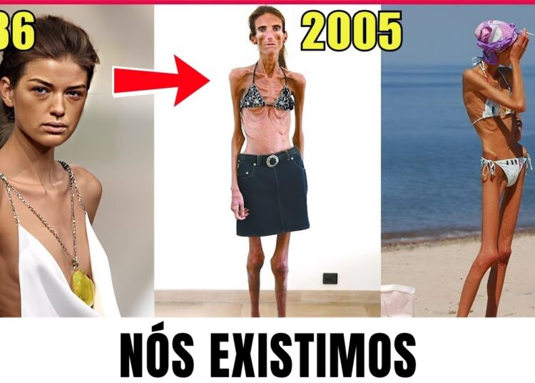 15 Celebridades mais magras que você não vai acreditar que existem