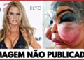 7 Desastres de Cirurgia Plástica de Celebridades | Antes e Depois 2025