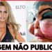 7 Desastres de Cirurgia Plástica de Celebridades | Antes e Depois 2025