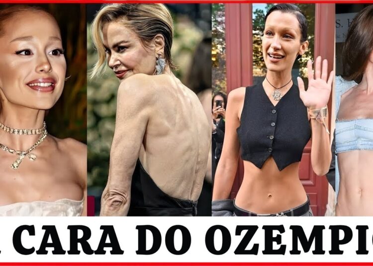 7 Celebridades com o “Rosto Ozempic” — Antes e Depois 2025