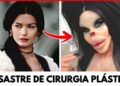 7 Celebridades Famosas Irreconhecíveis Após Cirurgias Plásticas Que Deram Errado