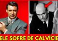 15 Estrelas da Era de Ouro Que Eram Carecas em Segredo e Usavam Perucas | Antes e Depois