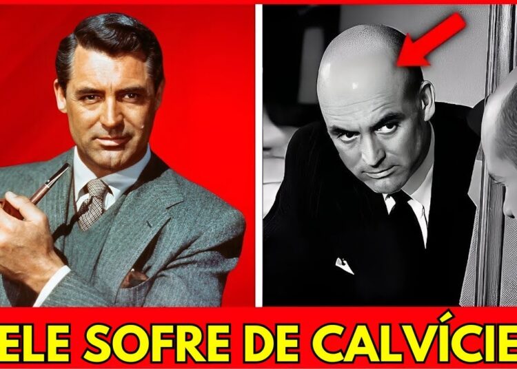 15 Estrelas da Era de Ouro Que Eram Carecas em Segredo e Usavam Perucas | Antes e Depois