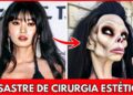 7 Maiores Desastres de Cirurgias Plásticas de Celebridades | Antes e Depois 2025