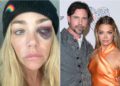 Denise Richards compartilha imagens de suposta violência doméstica do ex-marido Aaron Phypers em novos documentos judiciais.