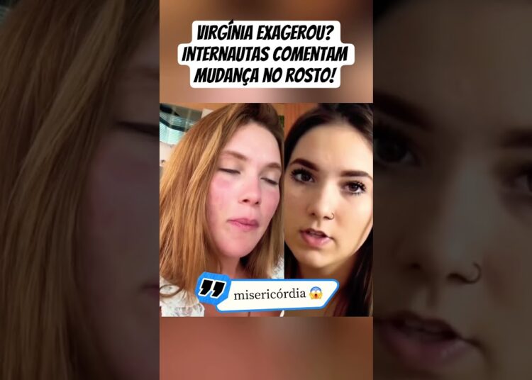 Antes e depois da Virgínia dá o que falar! #fofoca #virginia