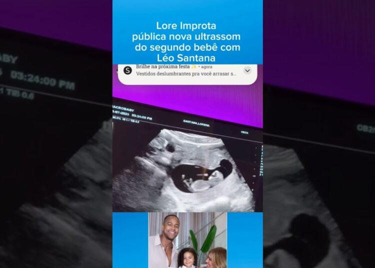 Lore Improta divulga nova ultrassom do seu bebê com Léo Santana #fofocas #gravidez #leosantana #lore
