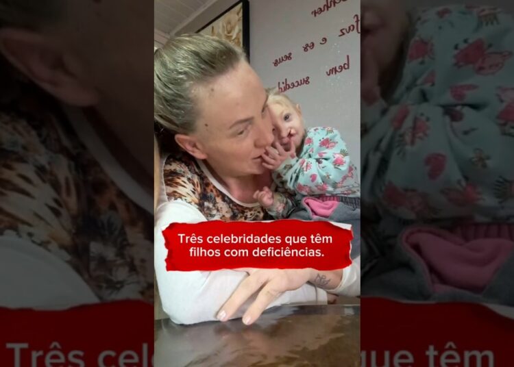 Três celebridades que têm filhos com deficiências.