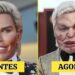 5 Desastres de Cirurgia Plástica de Celebridades Que Você Não Vai Reconhecer | Antes e Depois 2025