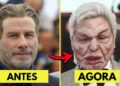 20 Celebridades Expulsas dos Holofotes Após Desastres de Cirurgia Plástica
