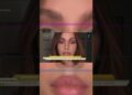Quais procedimentos Anitta realizou? Especialista analisa mudanças no rosto da cantora