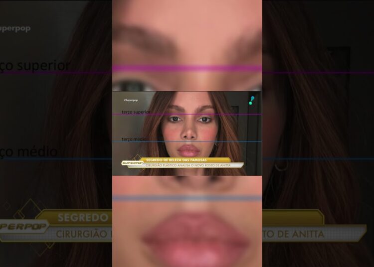 Quais procedimentos Anitta realizou? Especialista analisa mudanças no rosto da cantora