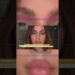 Quais procedimentos Anitta realizou? Especialista analisa mudanças no rosto da cantora