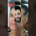 10 famosos antes e depois da Harmonização Facial. Incrível!    #shorts #famosos