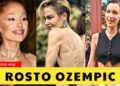 Celebridades com “Ozempic Face”: Antes e Depois 2025 que Chocaram o Mundo