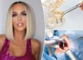 Por dentro das infecções de Jenny McCarthy causadas por um implante dentário com falha