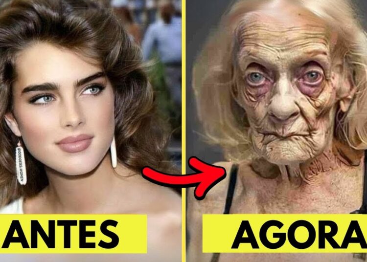 15 Celebridades que Envelheceram Muito Mal – Você Não Vai Reconhecê-las Agora