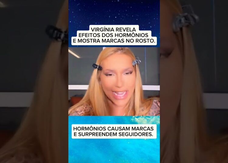 VIRGÍNIA REVELA EFEITOS DOS HORMÔNIOS E MOSTRA MARCAS NO ROSTO. #fofocas #noticias