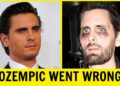 10 Most Shocking Ozempic Celebrity Transformations You Won’t Believe | Then and Now 2026