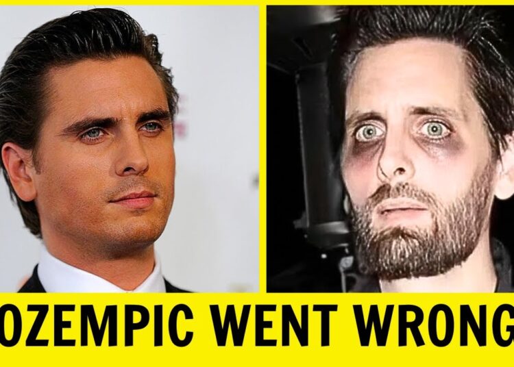 10 Most Shocking Ozempic Celebrity Transformations You Won’t Believe | Then and Now 2026
