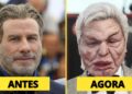 7 Cirurgias Plásticas de Celebridades que Arruinaram Suas Carreiras | Antes e Depois 2025
