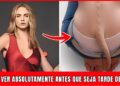 7 Famosos Com Deformidades Corporais Incomuns Que Vão Te Surpreender