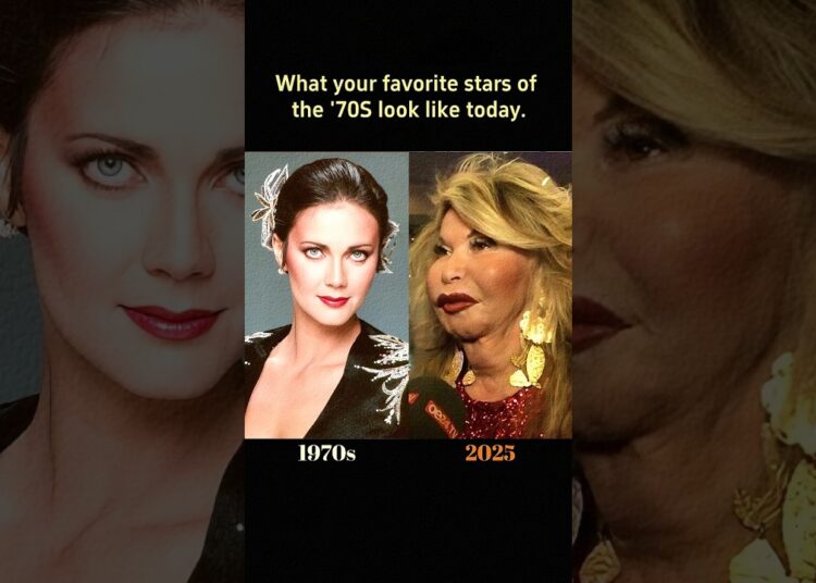 1970s Celebrities Then & Now ⭐ Cher, Travolta & More | #Shorts