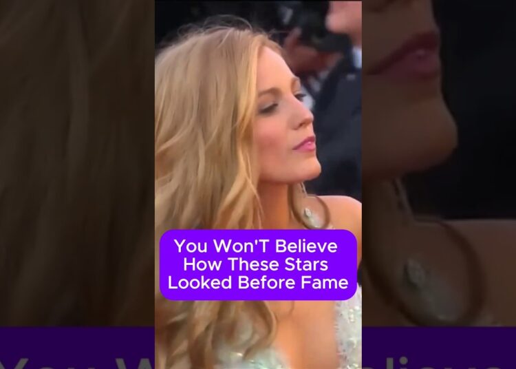 You Won’t Believe How These Stars Looked Before Fame #hollywood #celebrity #entertainment #shorts