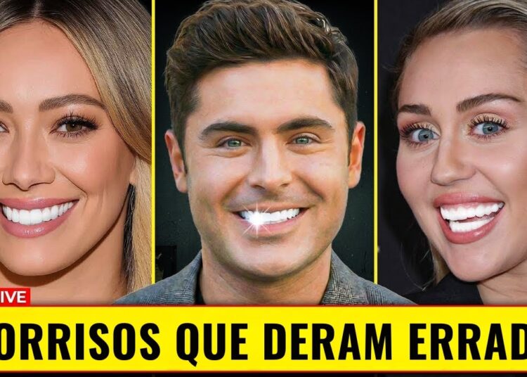 7 Celebridades Que Arruinaram o Sorriso com Lentes Dentais