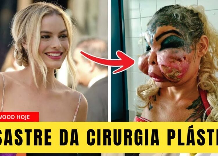 7 Famosos Antes e Depois da Plástica: As Mudanças Mais Chocantes de 2025!