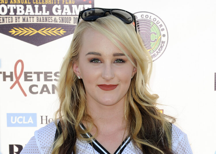 Camryn Magness, cantora que fez turnê com o One Direction, morre após acidente de scooter em Miami Beach – NBC 6 South Florida