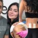 Kylie Jenner busca terapia com células-tronco no México
