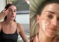 Mulher processa 'guru de cuidados com a pele' por danos faciais